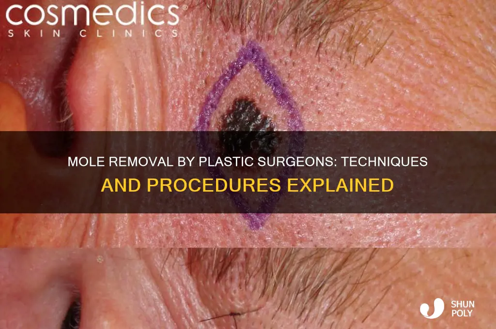how does a plastic surgeon remove a mole