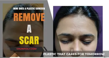 Scar Revision Techniques: How Plastic Surgeons Remove Scars Effectively