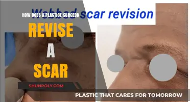 Scar Revision Techniques: How Plastic Surgeons Transform and Improve Scars