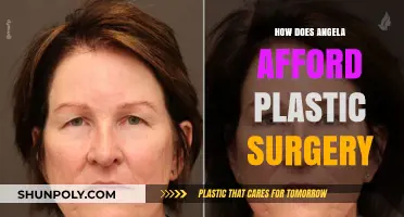 How Does Angela Afford Plastic Surgery? Exploring Her Financial Secrets