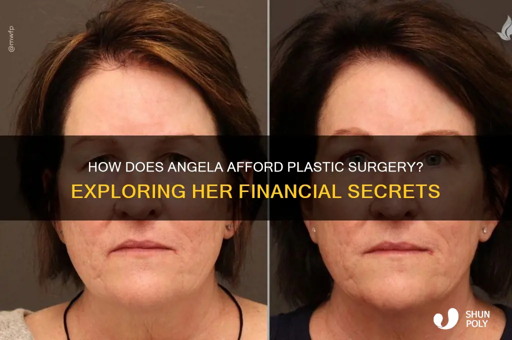 how does angela afford plastic surgery