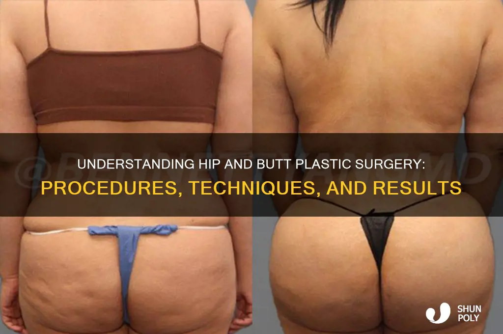 how does hip and butt plastic surgery work