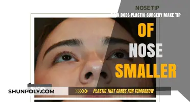 Nose Tip Refinement: How Plastic Surgery Achieves a Smaller Appearance