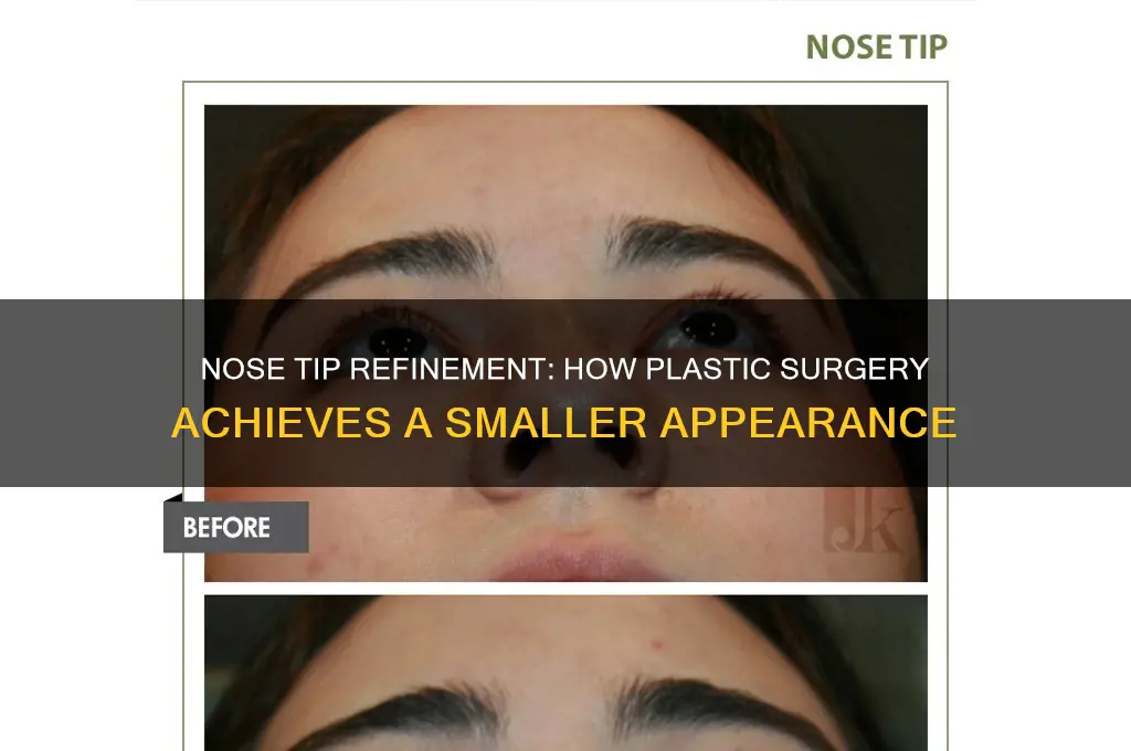 how does plastic surgery make tip of nose smaller