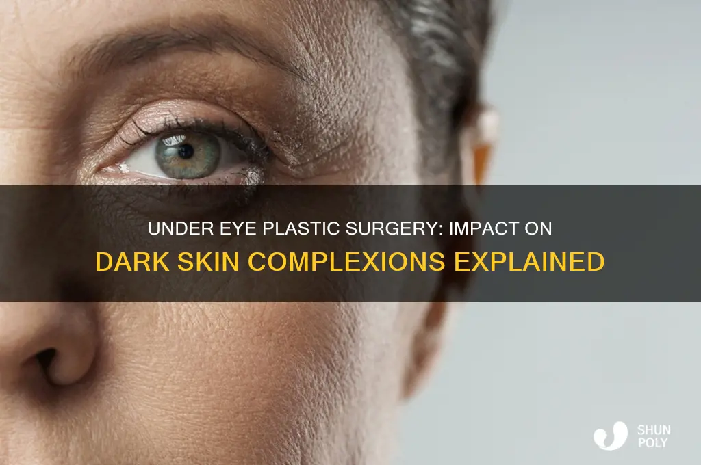 how does under eye plastic surgery affect dark skin