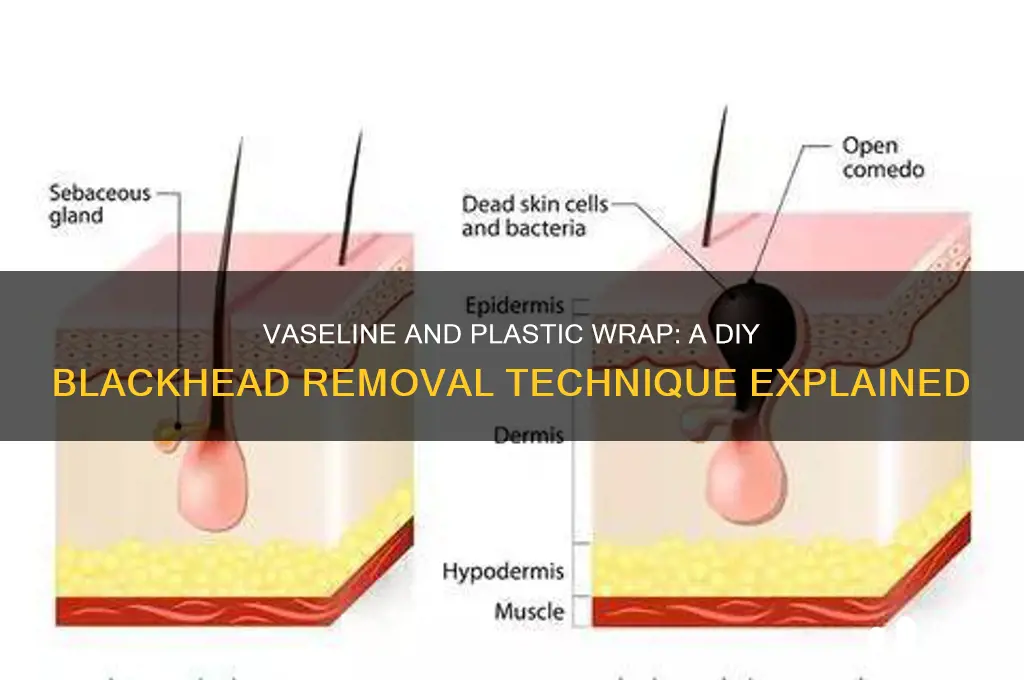 how does vaseline and plastic wrap remove blackheads