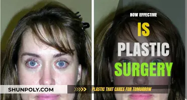 Plastic Surgery Effectiveness: Real Results, Risks, and Patient Satisfaction