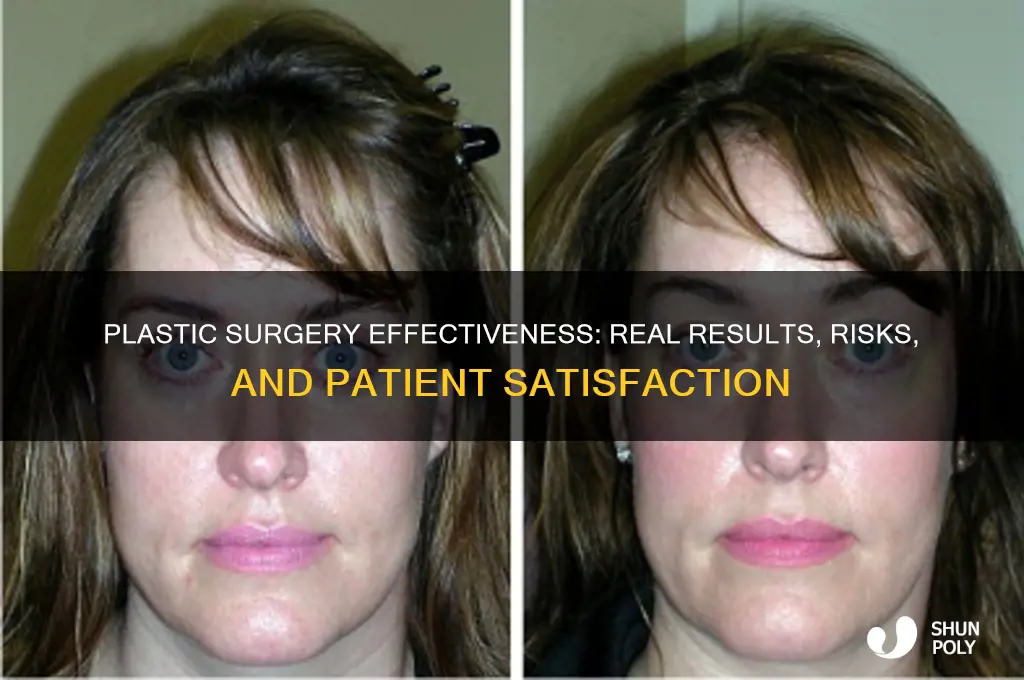 how effective is plastic surgery