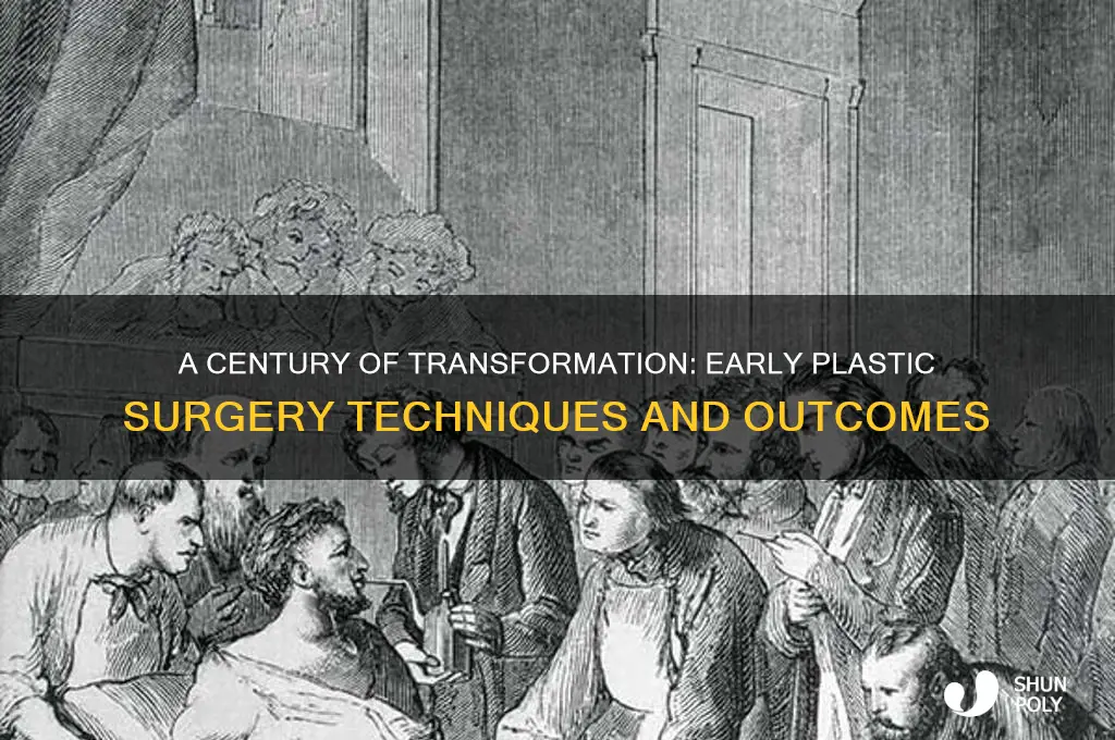 how good was plastic surgery 100 years ago