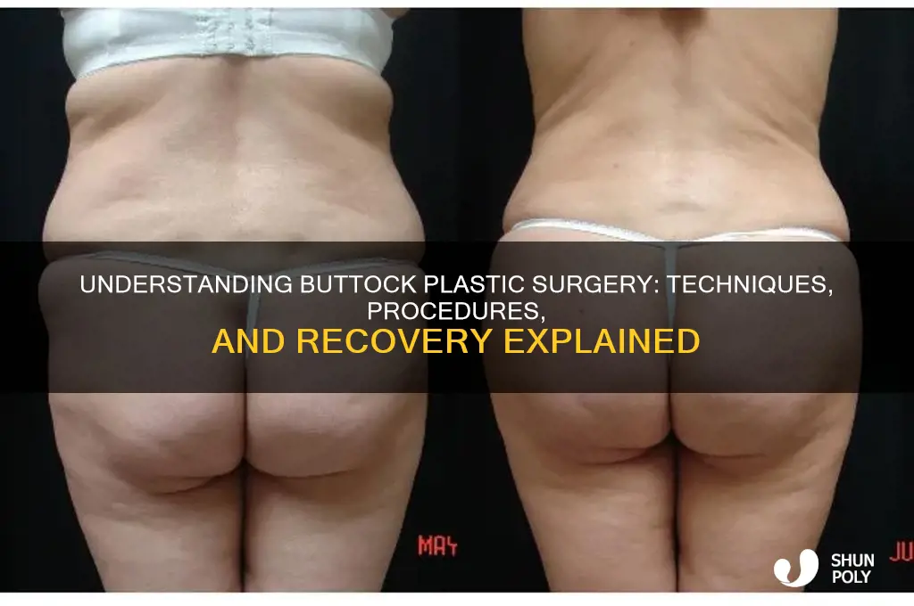 how is plastic surgery done on buttocks