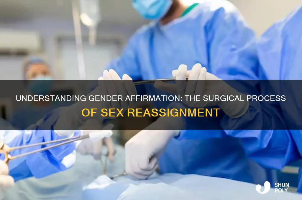 how is plastic surgery done on sex change
