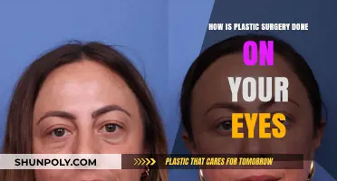 Understanding Eye Plastic Surgery: Techniques, Procedures, and Recovery Explained