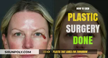 Understanding Skin Plastic Surgery: Techniques, Procedures, and Recovery Explained