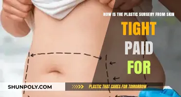 Skin Tight Plastic Surgery Costs: Who Pays and How?