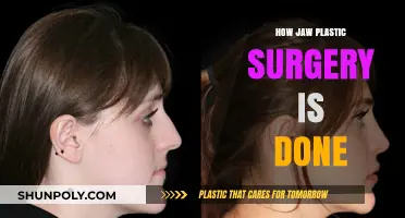 Jaw Plastic Surgery Explained: Techniques, Procedures, and Transformation Process