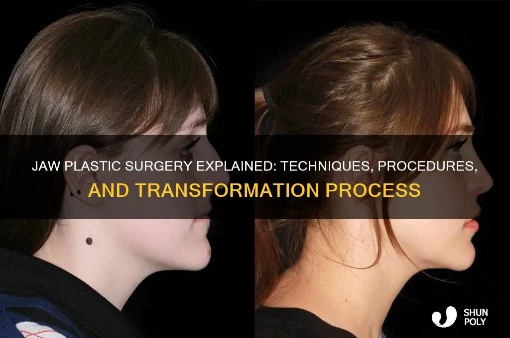 how jaw plastic surgery is done