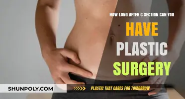 Post-C-Section Plastic Surgery: Timing and Recovery Guidelines Explained