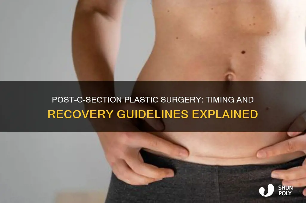how long after c section can you have plastic surgery