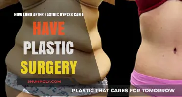 Post-Bariatric Plastic Surgery: Timing After Gastric Bypass Explained
