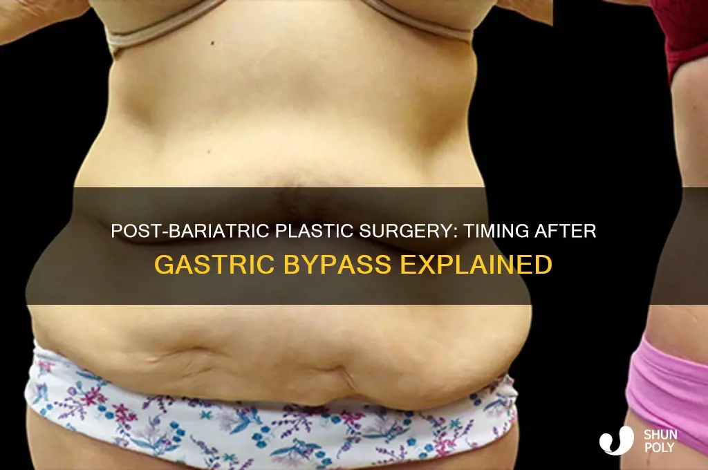how long after gastric bypass can i have plastic surgery