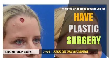 Timing Plastic Surgery Post-Mohs: What You Need to Know