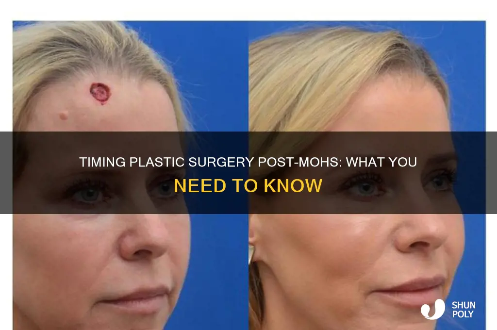 how long after mohs surgery can you have plastic surgery