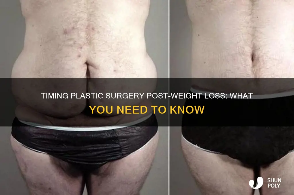 how long after weight loss for plastic surgery