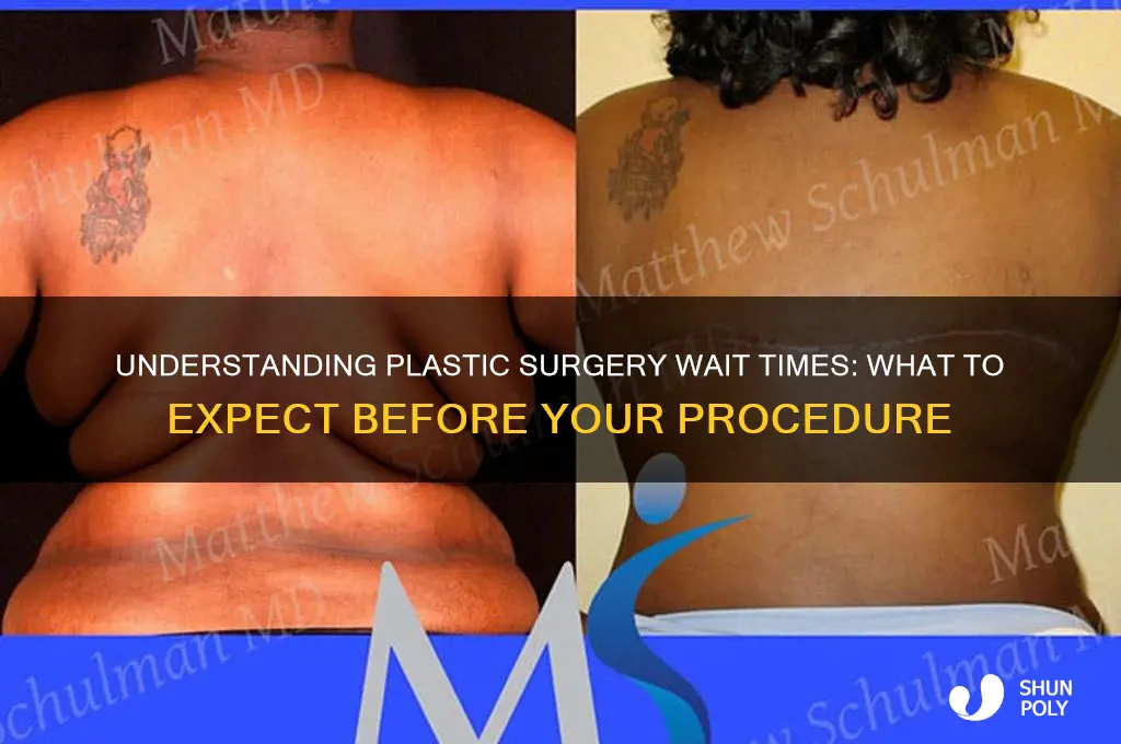 how long are wait times for plastic surgery