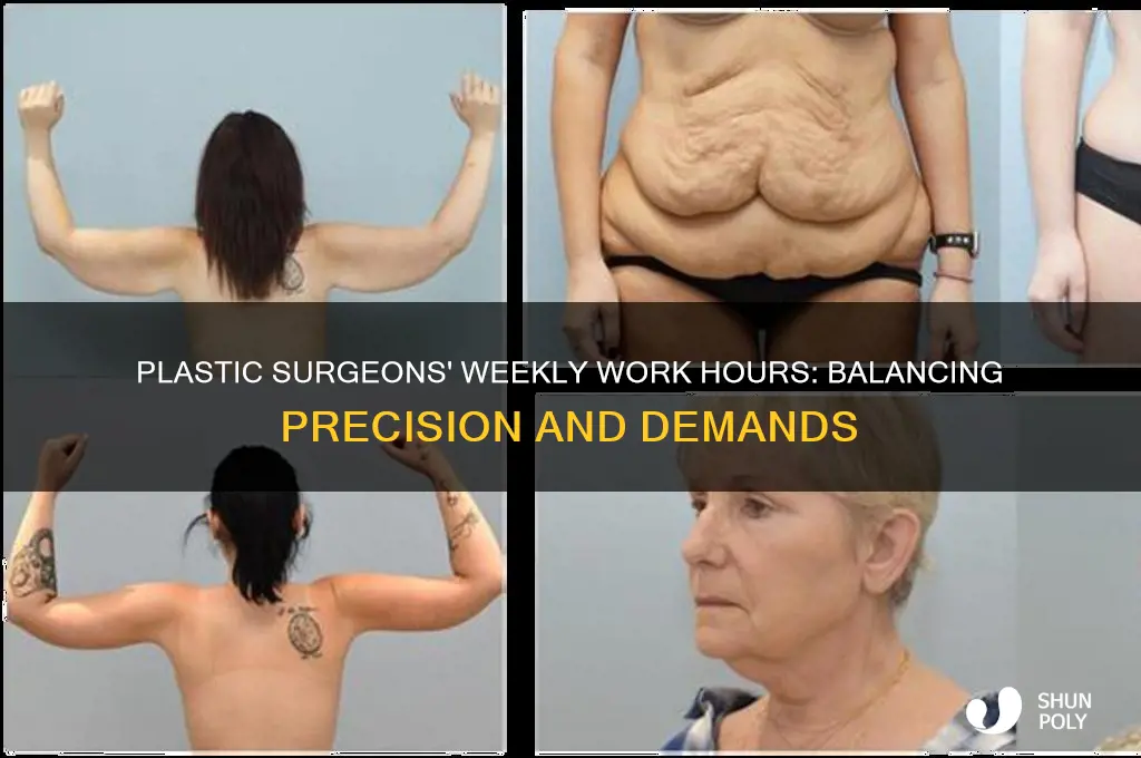 how long do plastic surgeons work a week
