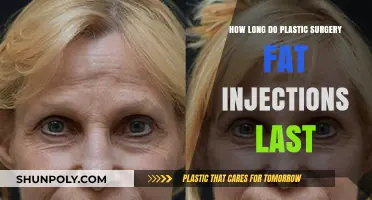 Fat Injections in Plastic Surgery: Longevity and What to Expect