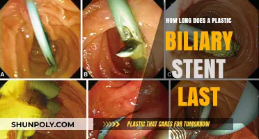 Understanding the Lifespan of Plastic Biliary Stents: A Comprehensive Guide
