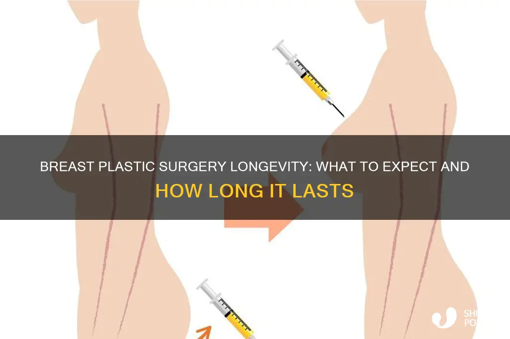how long does breast plastic surgery last