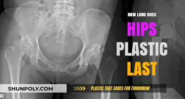 The Lifespan of Hip Plastics: What You Need to Know