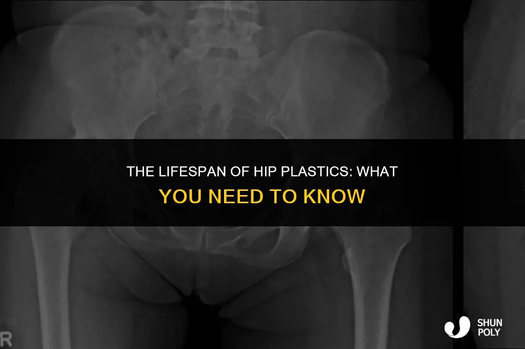 how long does hips plastic last