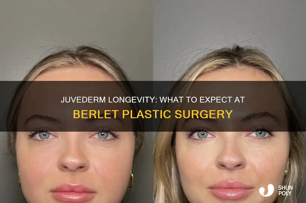 how long does juvederm last berlet plastic surgery
