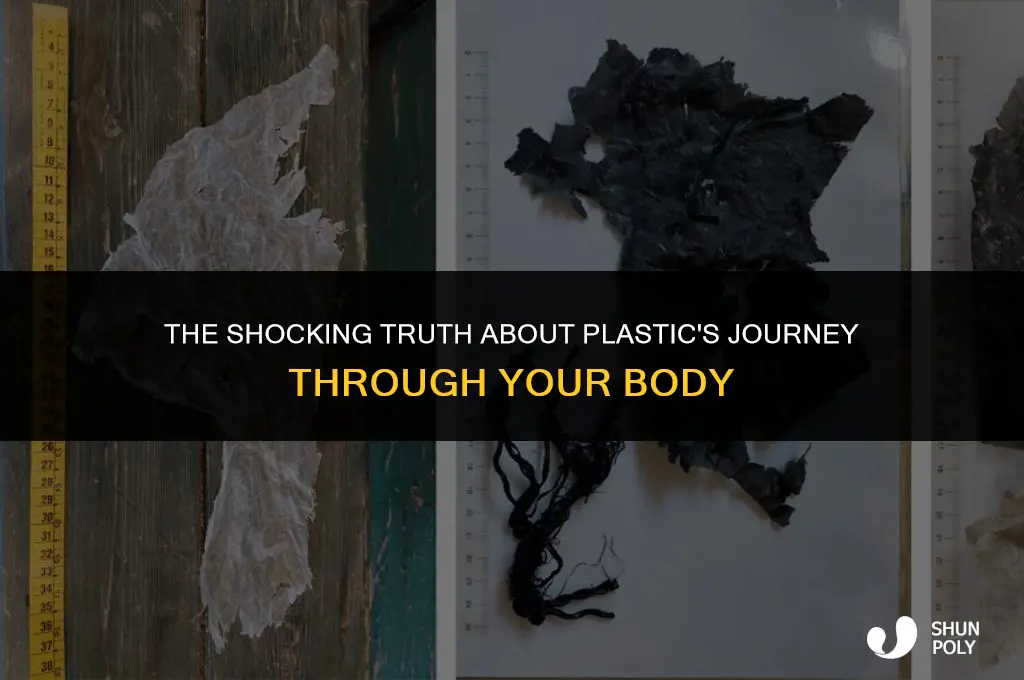 how long does plastic stay in your stomach