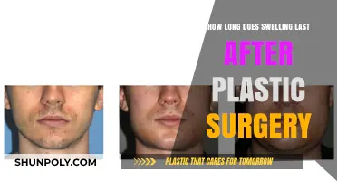 Post-Plastic Surgery Swelling: Duration, Recovery Tips, and What to Expect