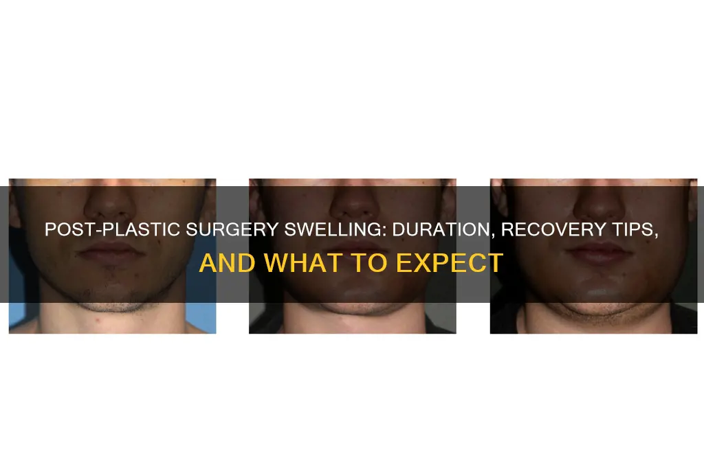 how long does swelling last after plastic surgery