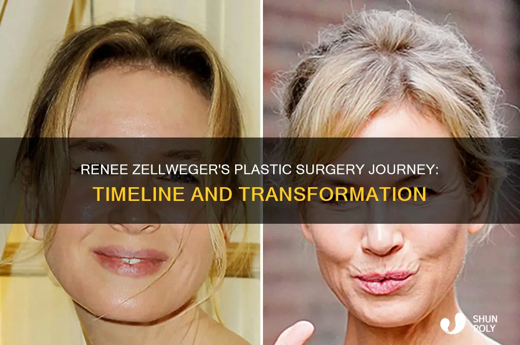 how long has renee zellweger been using plastic surgery