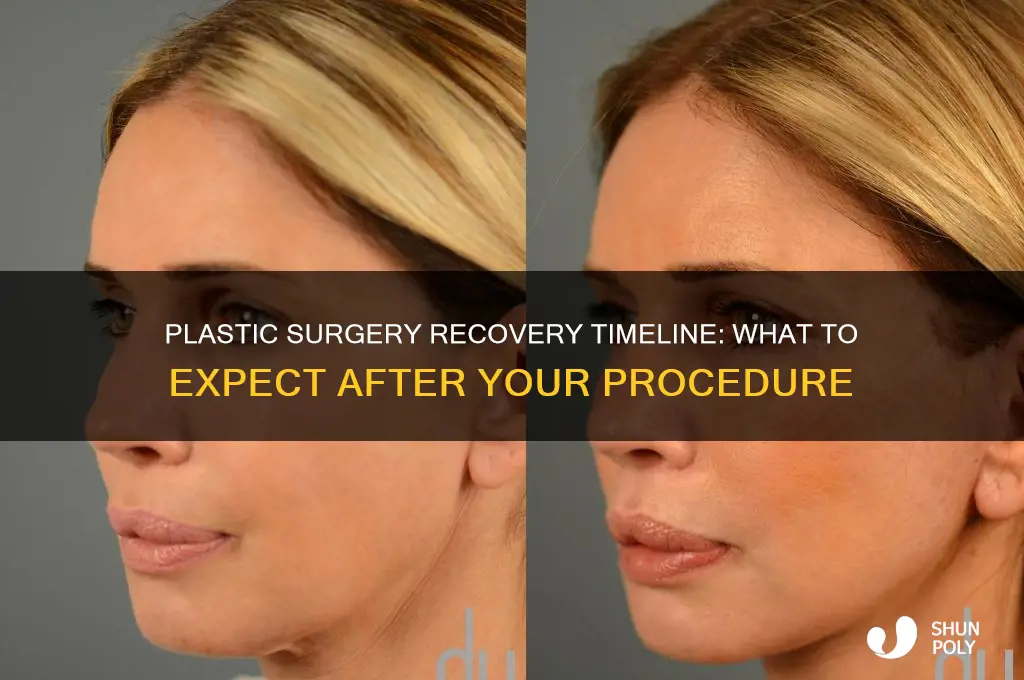 how long is plastic surgery recovery