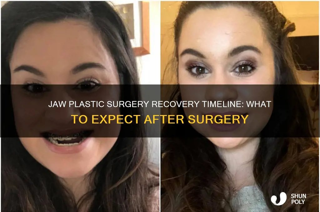 how long is recovery for jaw plastic surgery