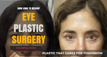Eye Plastic Surgery Recovery: Recouping Costs and Healing Time
