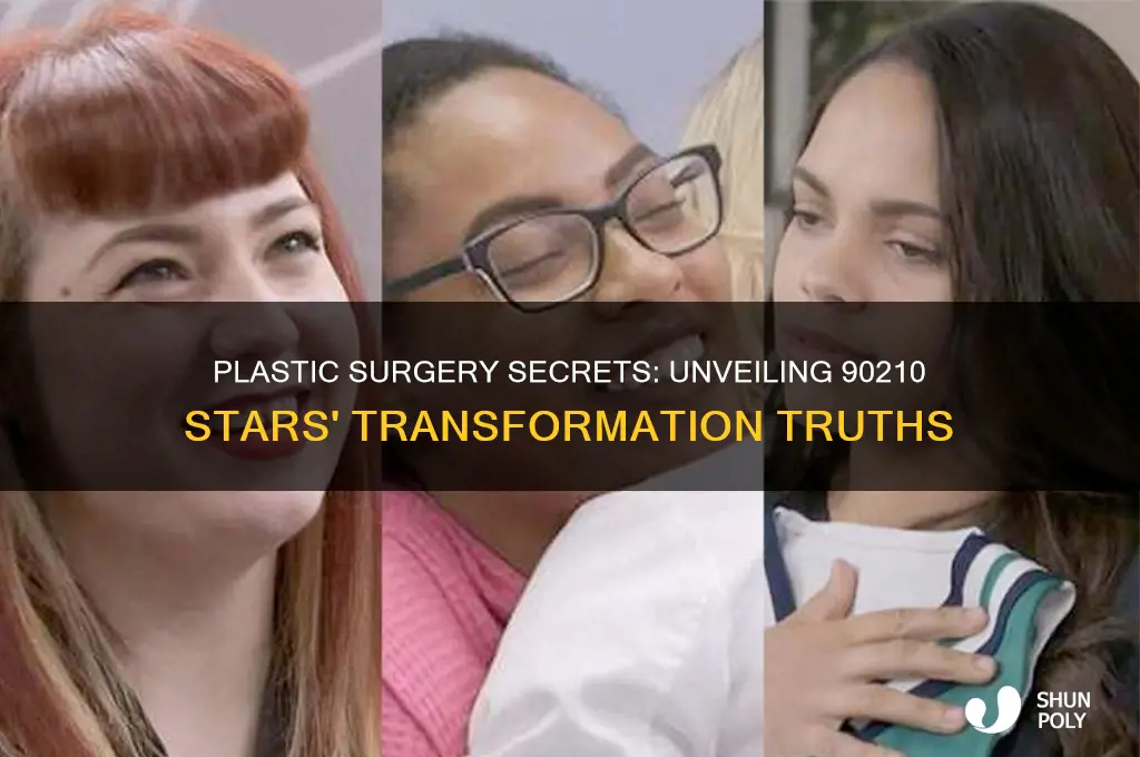 how many 90210 stars had plastic surgery