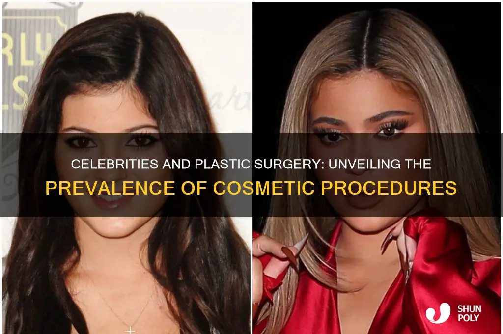 how many celebrities get plastic surgery
