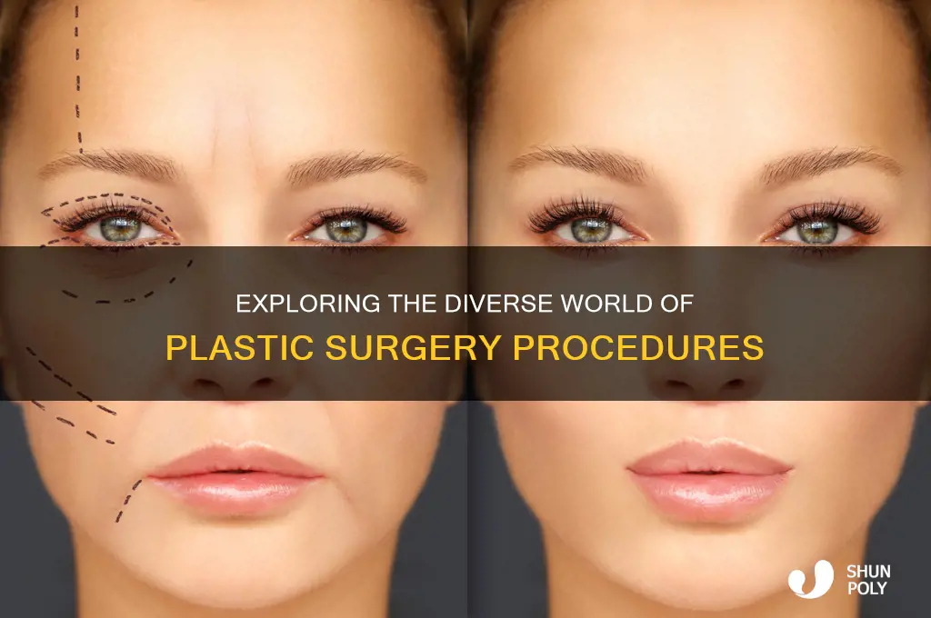 how many different plastic surgery procedures are there