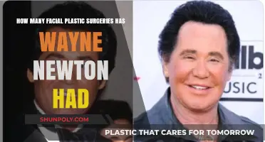 Wayne Newton's Facial Plastic Surgeries: Unveiling the Transformation Journey