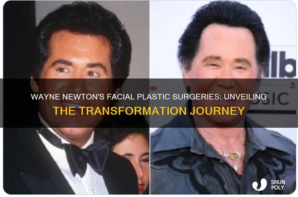 how many facial plastic surgeries has wayne newton had