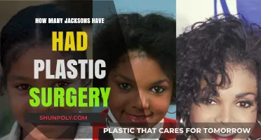 Exploring the Plastic Surgery Rumors of the Jackson Family