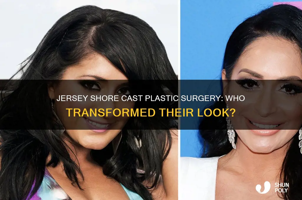 how many jersey shore cast got plastic surgery