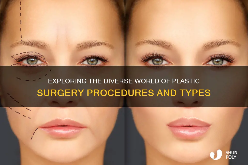 how many kinds of plastic surgery are there
